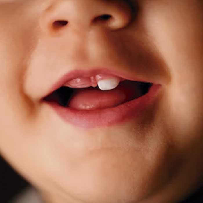 Orden habitual en que aparecen los Dientes de Leche y sus cuidados.