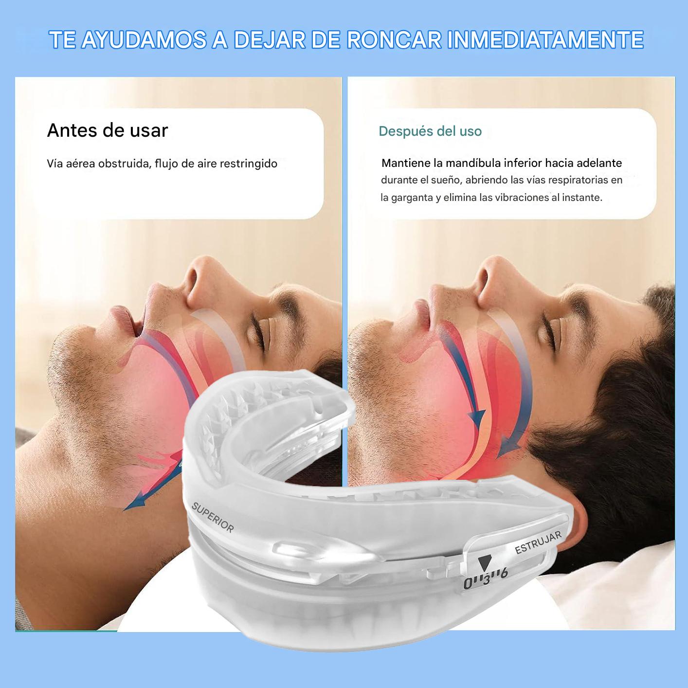 Dispositivo de Avance Mandibular