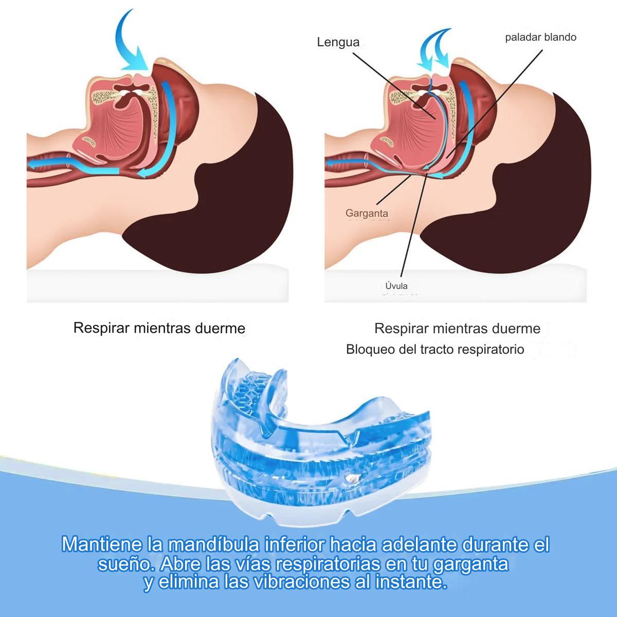 Dispositivo de Avance Mandibular con Desarmador.