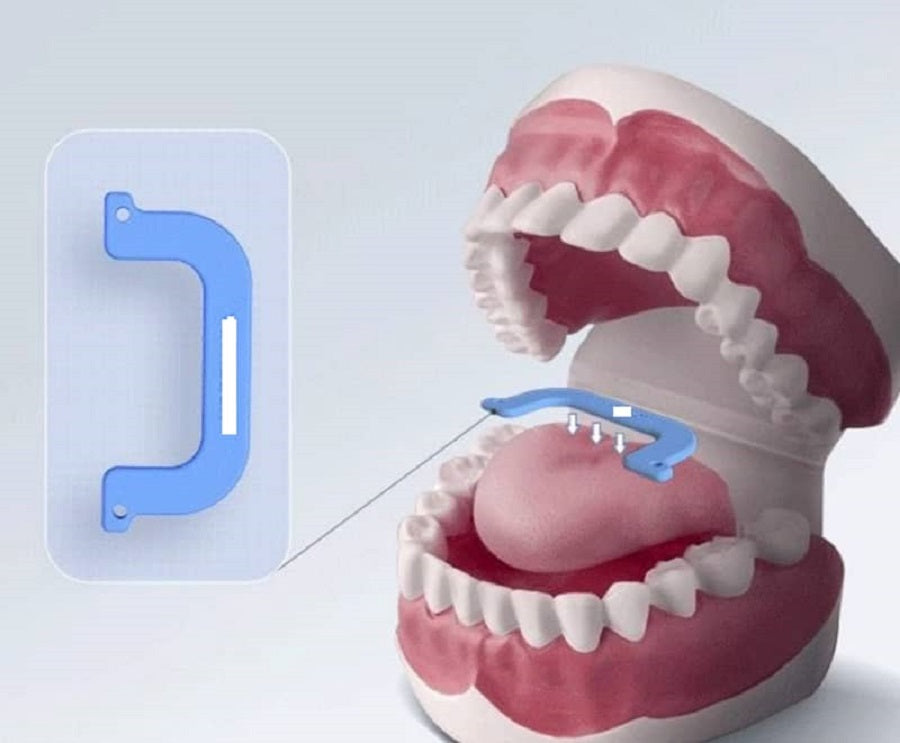 DISPOSITIVO DE AVANCE MANDIBULAR INTEGRAL CON BANDA LINGUAL